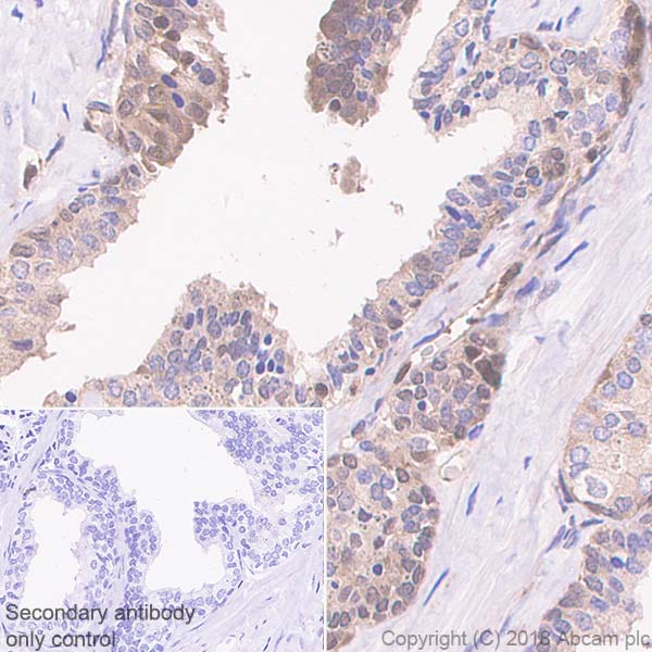 Immunohistochemistry (Formalin/PFA-fixed paraffin-embedded sections) - Anti-Proteasome 20S LMP2 antibody [EPR22042] (ab242061), expandable thumbnail