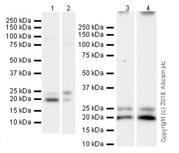 Western blot - Anti-Proteasome 20S LMP2 antibody [EPR22042] (ab242061), expandable thumbnail