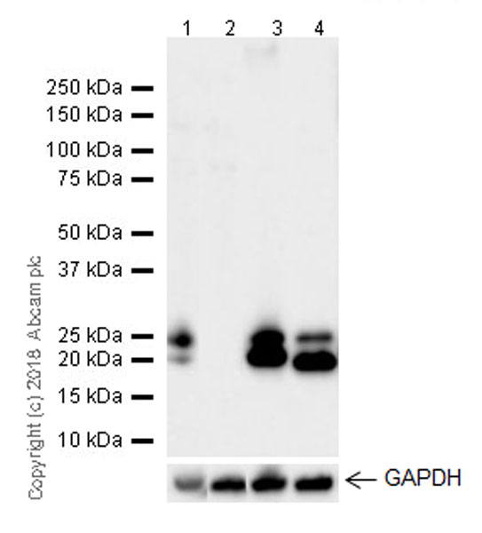 Western blot - Anti-Proteasome 20S LMP2 antibody [EPR22042] (ab242061), expandable thumbnail