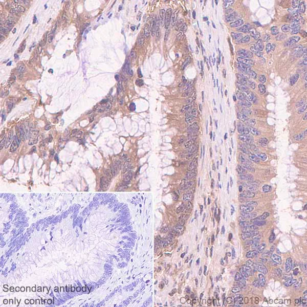 Immunohistochemistry (Formalin/PFA-fixed paraffin-embedded sections) - Anti-Proteasome 20S LMP2 antibody [EPR22042] - BSA and Azide free (AB243556)