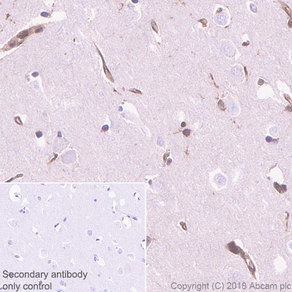 Immunohistochemistry (Formalin/PFA-fixed paraffin-embedded sections) - Anti-Proteasome 20S LMP2 antibody [EPR22042] - BSA and Azide free (AB243556)
