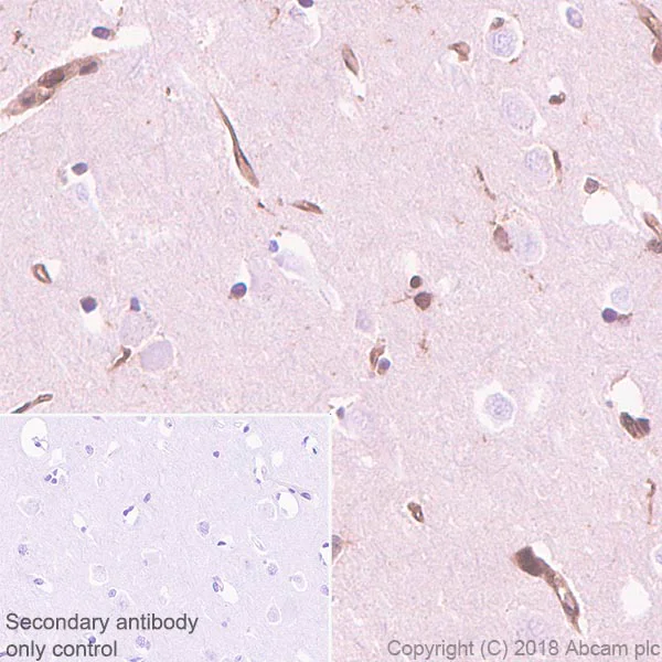 Immunohistochemistry (Formalin/PFA-fixed paraffin-embedded sections) - Anti-Proteasome 20S LMP2 antibody [EPR22042] - BSA and Azide free (AB243556)