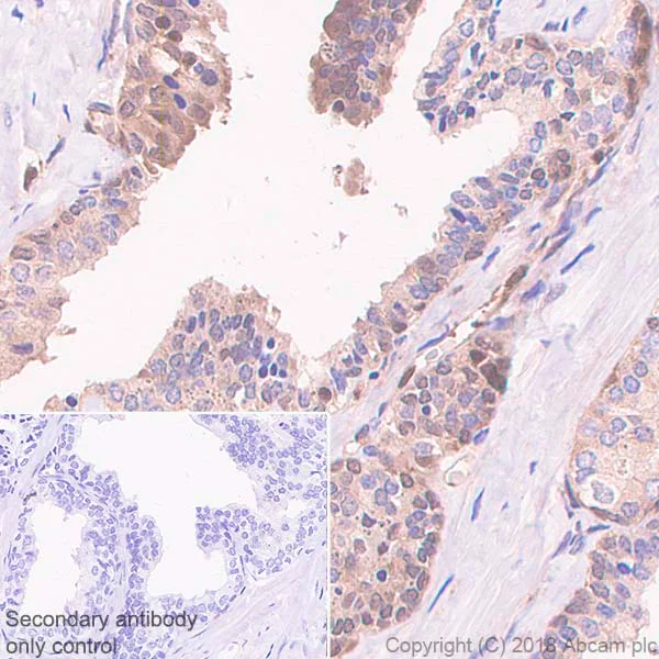 Immunohistochemistry (Formalin/PFA-fixed paraffin-embedded sections) - Anti-Proteasome 20S LMP2 antibody [EPR22042] - BSA and Azide free (AB243556)