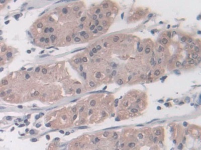 Immunohistochemistry (Formalin/PFA-fixed paraffin-embedded sections) - Anti-Proteasome 20S LMP7 antibody (AB232984), expandable thumbnail