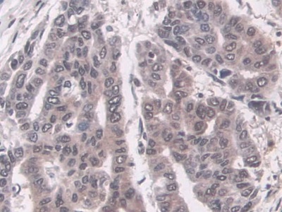 Immunohistochemistry (Formalin/PFA-fixed paraffin-embedded sections) - Anti-Proteasome 20S LMP7 antibody (ab232984), expandable thumbnail