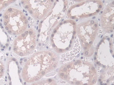 Immunohistochemistry (Formalin/PFA-fixed paraffin-embedded sections) - Anti-Proteasome 20S LMP7 antibody (AB232984), expandable thumbnail