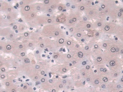 Immunohistochemistry (Formalin/PFA-fixed paraffin-embedded sections) - Anti-Proteasome 20S LMP7 antibody (ab232984), expandable thumbnail