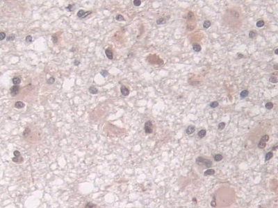 Immunohistochemistry (Formalin/PFA-fixed paraffin-embedded sections) - Anti-Proteasome 20S LMP7 antibody (AB232984), expandable thumbnail