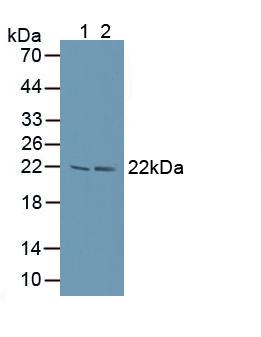 Western blot - Anti-Proteasome 20S LMP7 antibody (AB232984), expandable thumbnail