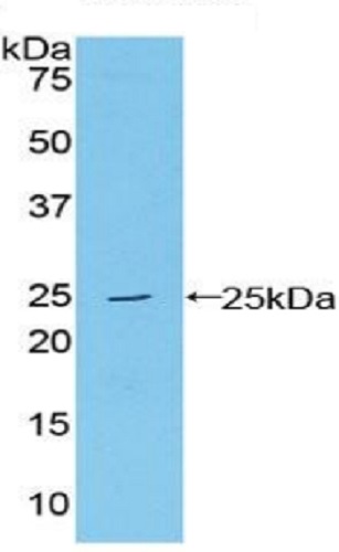 Western blot - Anti-Proteasome 20S LMP7 antibody (ab232984), expandable thumbnail