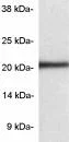 Western blot - Anti-Proteasome 20S LMP7 antibody (AB3329)
