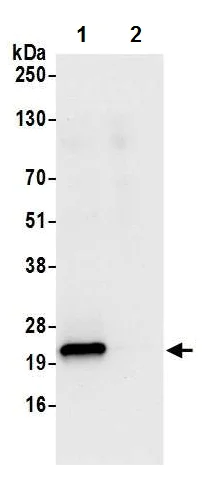 Immunoprecipitation - Anti-Proteasome 20S LMP7 antibody - C-terminal (AB226359)