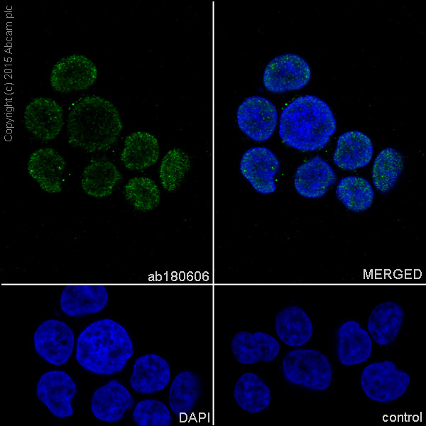 Immunocytochemistry/ Immunofluorescence - Anti-Proteasome 20S LMP7 antibody [EPR14482(B)] (AB180606)