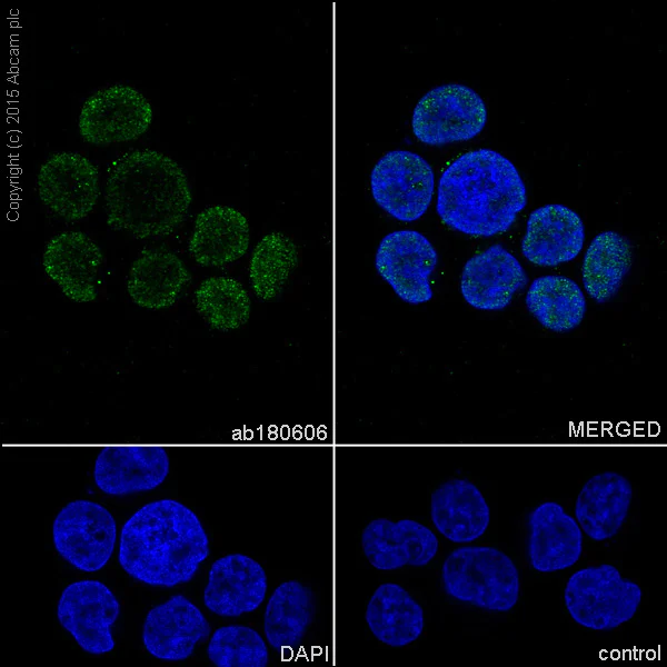 Immunocytochemistry/ Immunofluorescence - Anti-Proteasome 20S LMP7 antibody [EPR14482(B)] (AB180606)