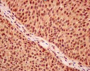 Immunohistochemistry (Formalin/PFA-fixed paraffin-embedded sections) - Anti-Proteasome 20S LMP7 antibody [EPR14482(B)] (AB180606)