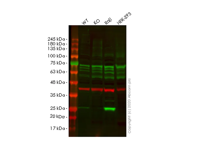 Western blot - Anti-Proteasome 20S LMP7 antibody [EPR14482(B)] (AB180606)