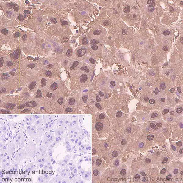 Immunohistochemistry (Formalin/PFA-fixed paraffin-embedded sections) - Anti-Proteasome 20S LMP7 antibody [EPR14482(B)] - BSA and Azide free (AB246363)