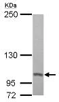 Western blot - Anti-Proteasome 26S S2/PSMD2 antibody (AB125914)