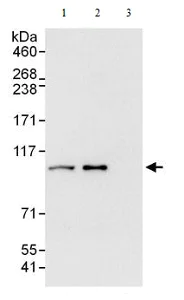 Immunoprecipitation - Anti-Proteasome 26S S2/PSMD2 antibody (AB140675)