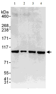 Western blot - Anti-Proteasome 26S S2/PSMD2 antibody (AB140675)