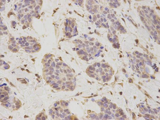 Immunohistochemistry (Formalin/PFA-fixed paraffin-embedded sections) - Anti-Proteasome 26S S2/PSMD2 antibody (AB197054)