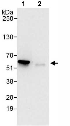 Immunoprecipitation - Anti-Proteasome 26S S3/PSMD3 antibody (AB140440)
