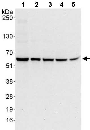 Western blot - Anti-Proteasome 26S S3/PSMD3 antibody (AB140440)