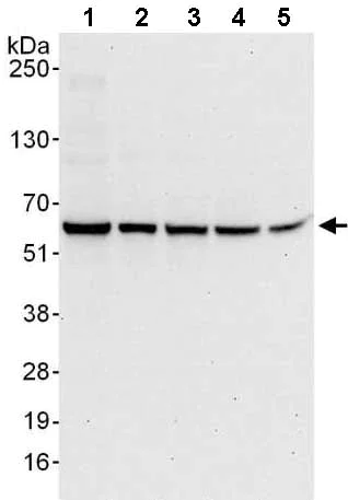 Western blot - Anti-Proteasome 26S S3/PSMD3 antibody (AB140440)