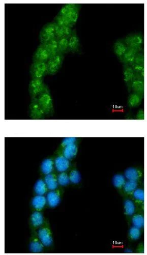 Immunocytochemistry/ Immunofluorescence - Anti-Proteasome 26S S3/PSMD3 antibody (AB154939)