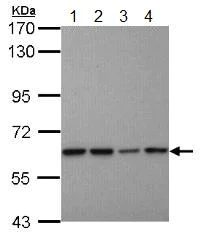 Western blot - Anti-Proteasome 26S S3/PSMD3 antibody (AB154939)