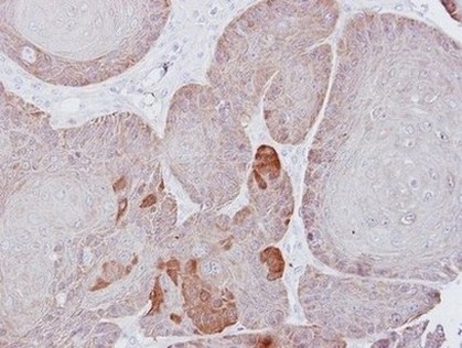 Immunohistochemistry (Formalin/PFA-fixed paraffin-embedded sections) - Anti-Proteasome 26S S3/PSMD3 antibody (AB154963), expandable thumbnail