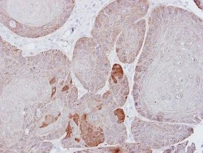 Immunohistochemistry (Formalin/PFA-fixed paraffin-embedded sections) - Anti-Proteasome 26S S3/PSMD3 antibody (AB154963)