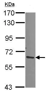 Western blot - Anti-Proteasome 26S S3/PSMD3 antibody (AB154963)