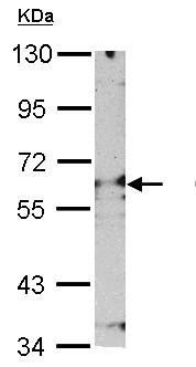 Western blot - Anti-Proteasome 26S S3/PSMD3 antibody (AB154963), expandable thumbnail