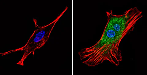 Immunocytochemistry/ Immunofluorescence - Anti-Proteasome 26S S3/PSMD3 antibody (AB3316)