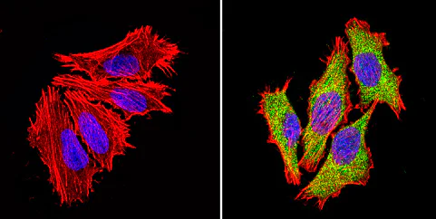 Immunocytochemistry/ Immunofluorescence - Anti-Proteasome 26S S3/PSMD3 antibody (AB3316)