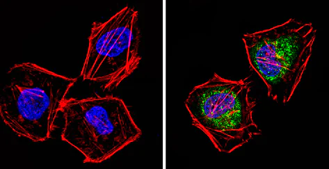 Immunocytochemistry/ Immunofluorescence - Anti-Proteasome 26S S3/PSMD3 antibody (AB3316)