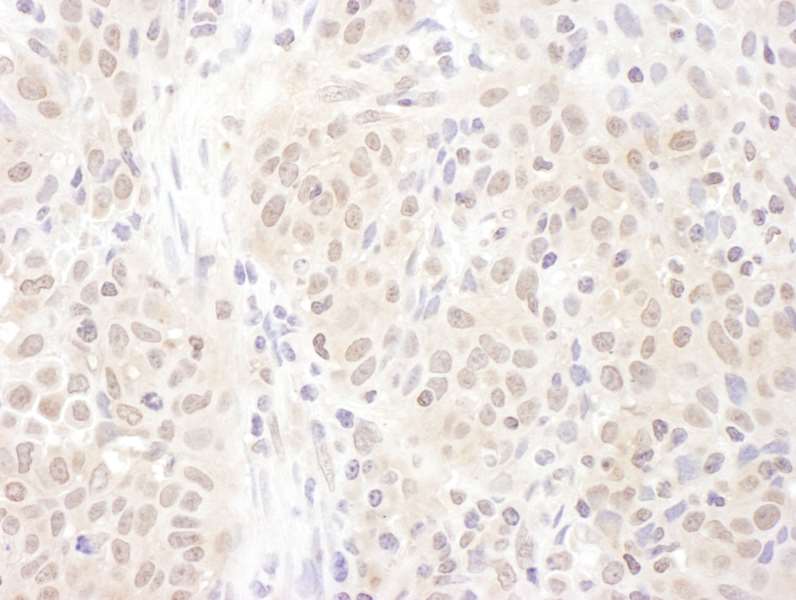 Immunohistochemistry (Formalin/PFA-fixed paraffin-embedded sections) - Anti-Proteasome Activator Subunit 4/PSME4 antibody (AB157158), expandable thumbnail