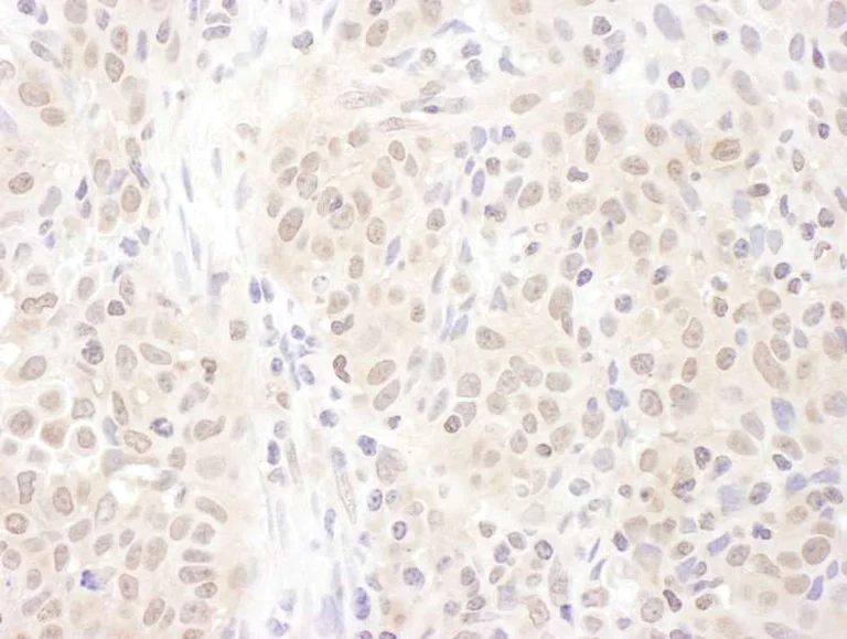 Immunohistochemistry (Formalin/PFA-fixed paraffin-embedded sections) - Anti-Proteasome Activator Subunit 4/PSME4 antibody (AB157158)