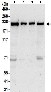 Western blot - Anti-Proteasome Activator Subunit 4/PSME4 antibody (AB157158), expandable thumbnail