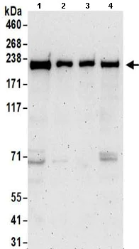 Western blot - Anti-Proteasome Activator Subunit 4/PSME4 antibody (AB157158)