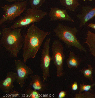 Immunocytochemistry/ Immunofluorescence - Anti-Proteasome Activator Subunit 4/PSME4 antibody (AB5620)