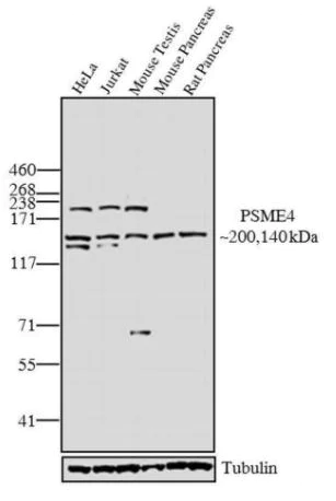 Western blot - Anti-Proteasome Activator Subunit 4/PSME4 antibody (AB5620)