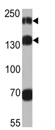 Western blot - Anti-Proteasome Activator Subunit 4/PSME4 antibody (AB5620)