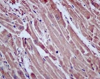 Immunohistochemistry (Formalin/PFA-fixed paraffin-embedded sections) - Anti-Proteasome Activator Subunit 4/PSME4 antibody [EPR13577(B)] - BSA and Azide free (AB238996)