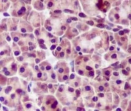 Immunohistochemistry (Formalin/PFA-fixed paraffin-embedded sections) - Anti-Proteasome Activator Subunit 4/PSME4 antibody [EPR13577(B)] - BSA and Azide free (AB238996)