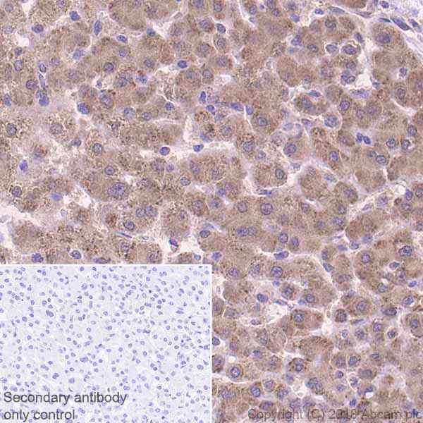 Immunohistochemistry (Formalin/PFA-fixed paraffin-embedded sections) - Anti-Proteasome Activator Subunit 4/PSME4 antibody [EPR13577(B)] - C-terminal (AB181203)
