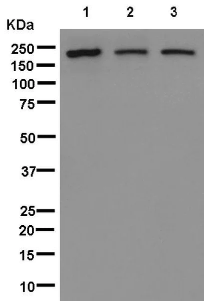 Western blot - Anti-Proteasome Activator Subunit 4/PSME4 antibody [EPR13577(B)] - C-terminal (AB181203)
