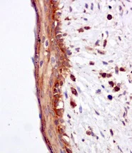 Immunohistochemistry (Formalin/PFA-fixed paraffin-embedded sections) - Anti-Proteasome maturation protein antibody [EPR10177] (AB170865)