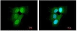 Immunocytochemistry/ Immunofluorescence - Anti-Proteasome subunit alpha type 6 antibody (AB97563), expandable thumbnail